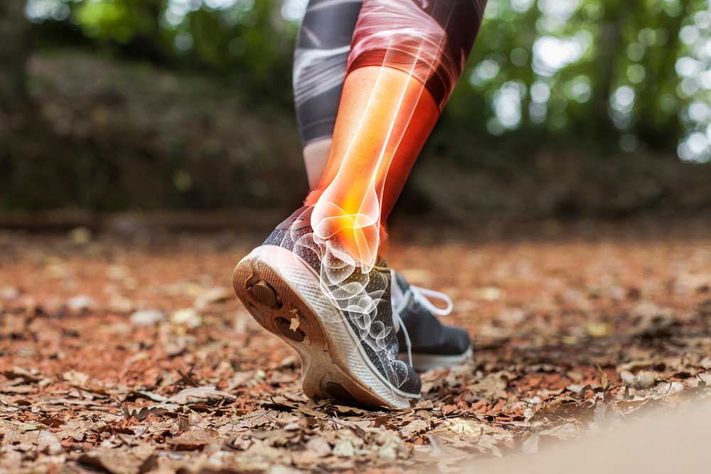 AI image of a woman's legs and feet in running gear walking on a leave-covered path. The calf, ankle, and foot of her right leg is overlaid with an X-ray showing the bones beneath in a red and orange glow