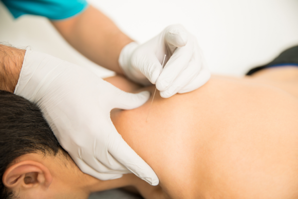 Gloved hands inserting a long acupuncture needle into a woman's neck