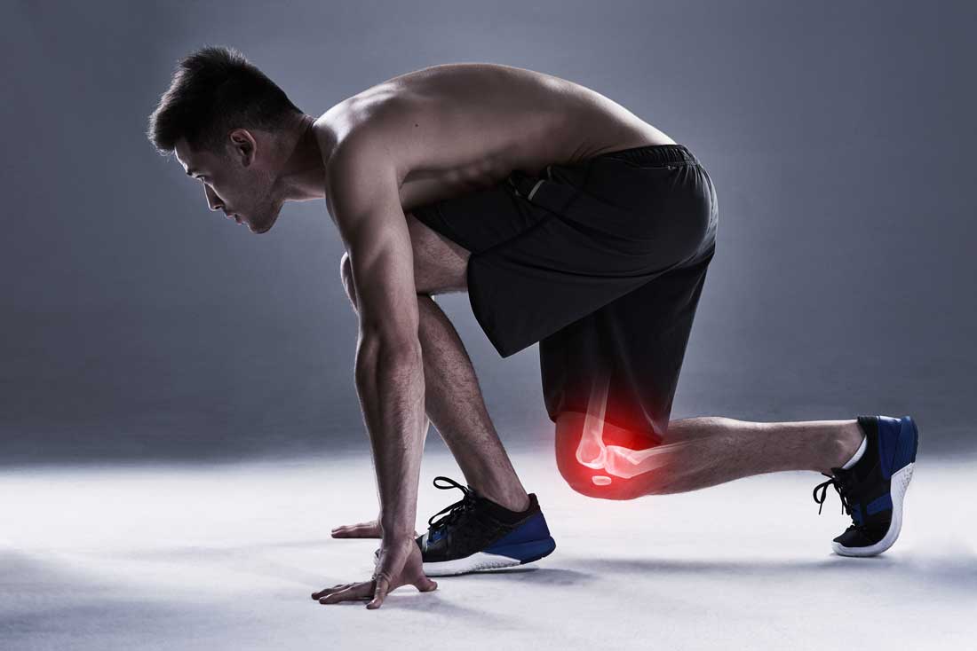 AI image of a lean, shirtless man in a runner's starting stance, his knee featuring a graphic of a glowing red X-ray of the bones beneath
